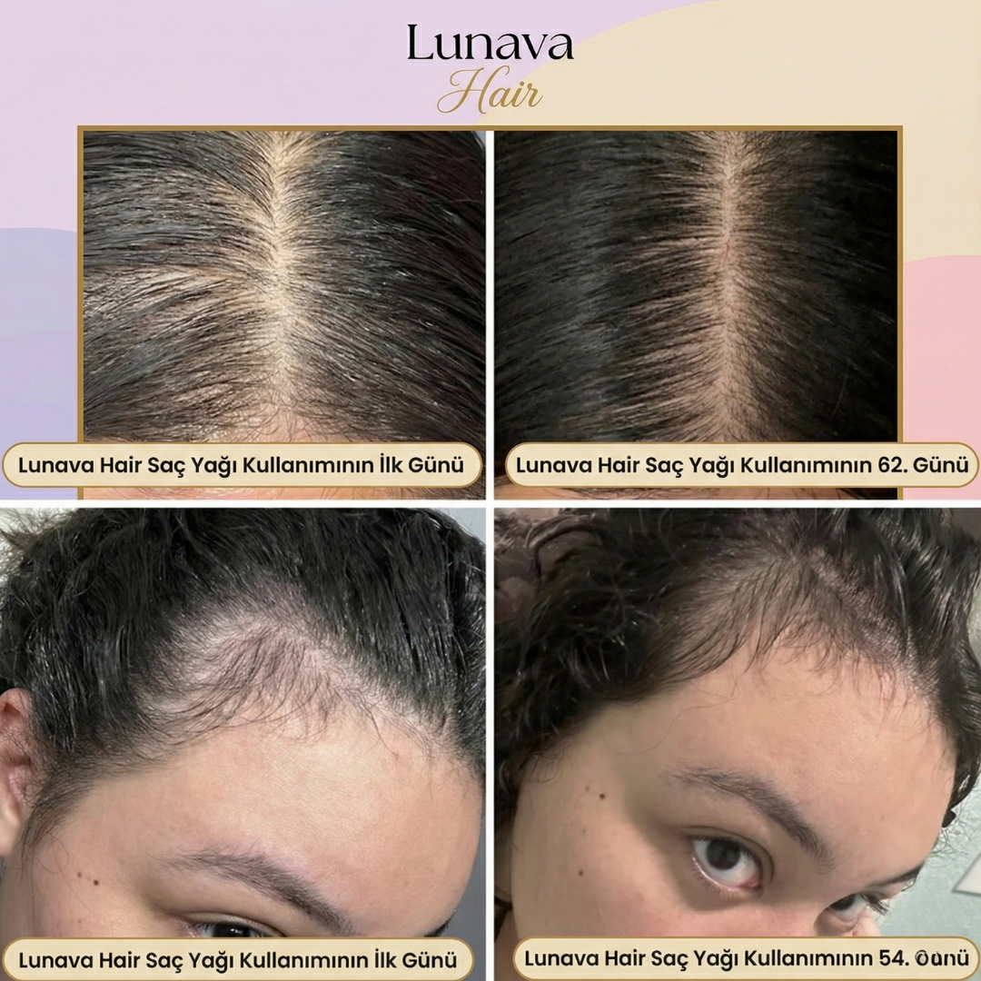 Lunava Hair – Premium Doğal Saç Uzatma Yağı